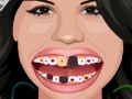 Spiel Selena Gomez Perfect Teeth 