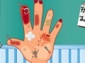 Spiel Hand Surgery