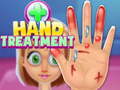 Spiel Hand Treatment
