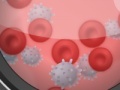 Spiel Operate Now: Appendix Surgery