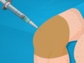 Spiel Operate Now: Knee Surgery